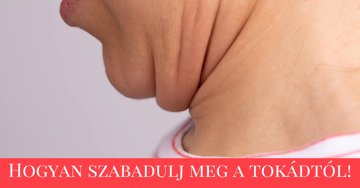 You are currently viewing Hogyan szabadulj meg a tokádtól!