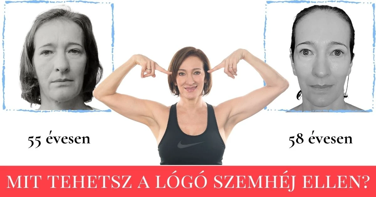 You are currently viewing SZEMHÉJPLASZTIKAI TAPASZTALATOM <br> amit bárcsak tudtam volna előtte